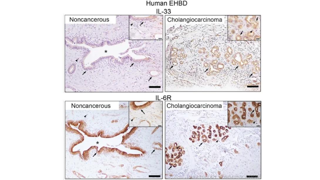 Hedgehog Signaling Modulates Interleukin-33-Dependent Extrahepatic Bile Duct Cell Proliferation in Mice.