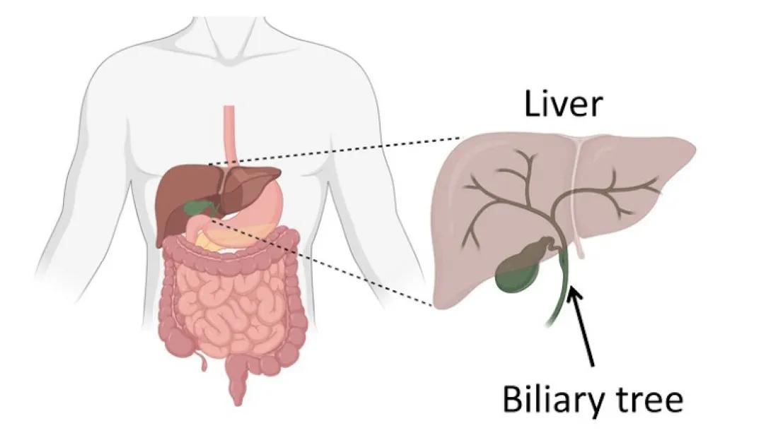 Diagram of human torso with organs with a close up view of the liver and biliary tree