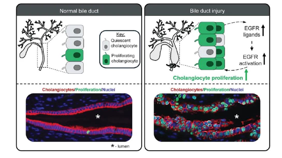 EGFR activation in cholangiocytes promotes extrahepatic bile duct regeneration after injury