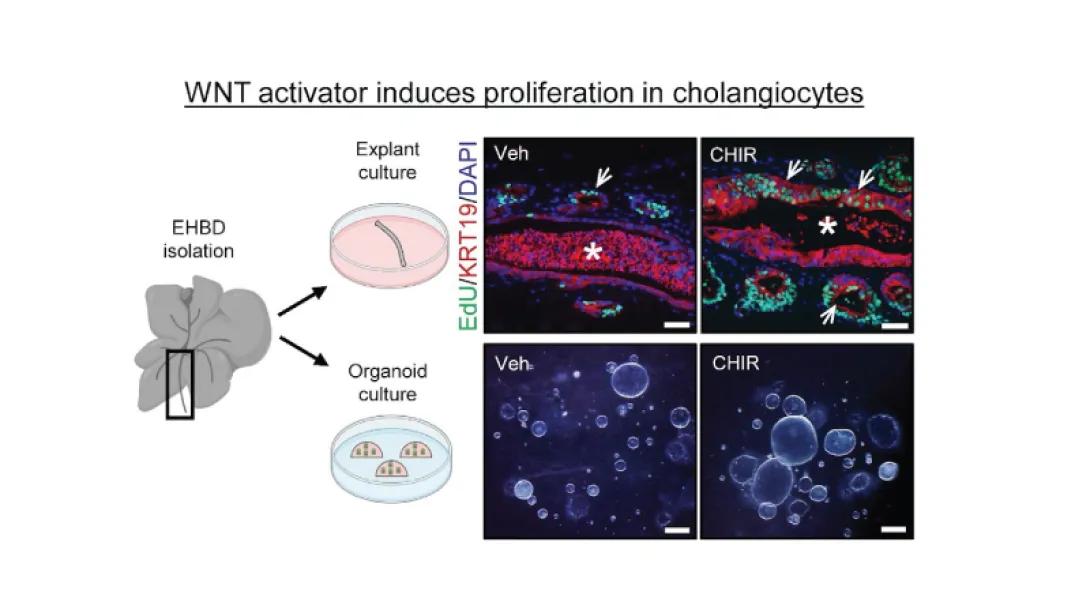 WNT signaling contributes to the extrahepatic bile duct proliferative response to obstruction in mice.
