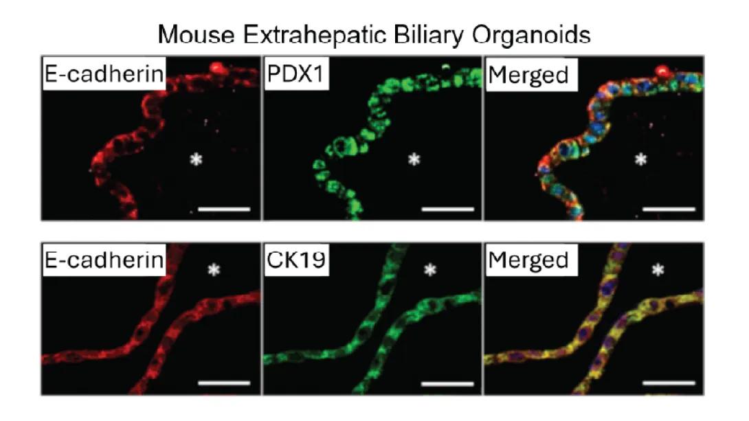 Generation of Organoids from Mouse Extrahepatic Bile Ducts