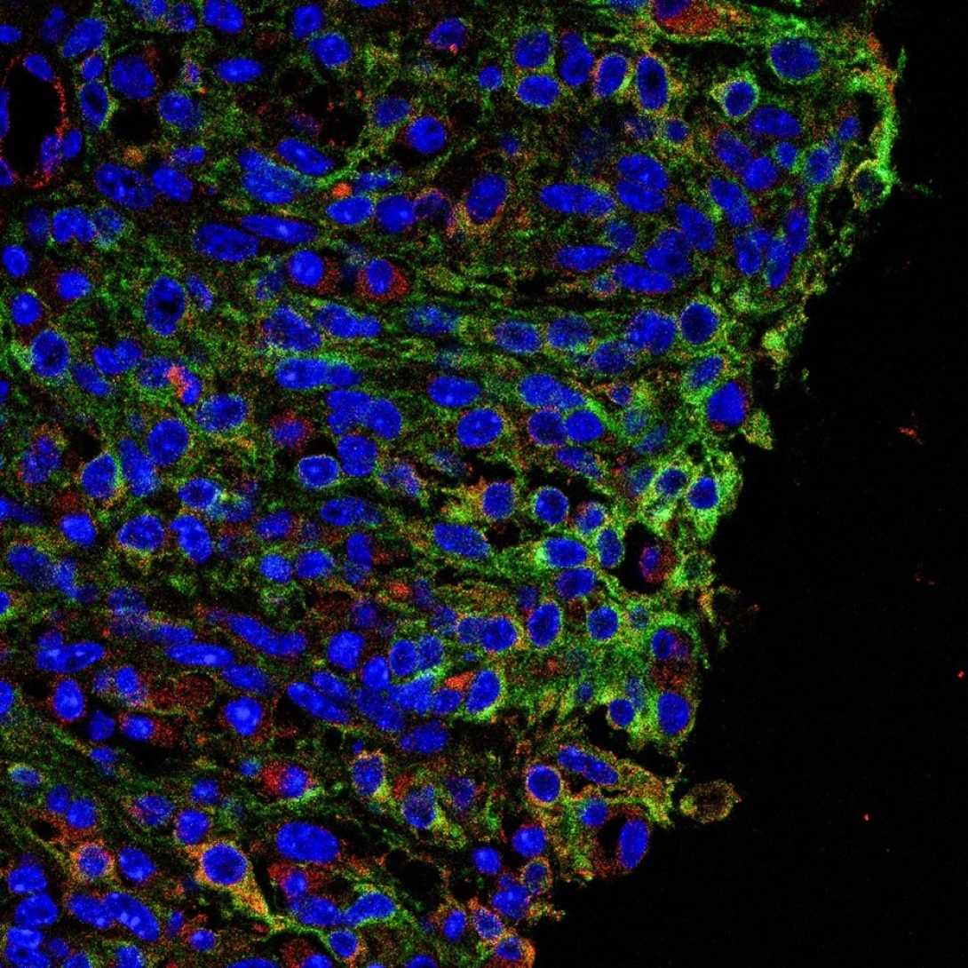 Immunofluorescence staining for ACSL4 (red), PDGFRα (green) and Hoechst (blue) in colon tissue from IBD mouse model.