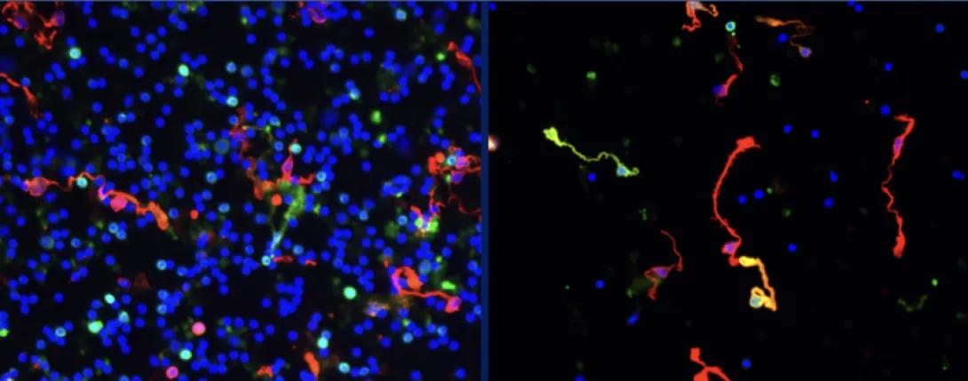 Representative images of dissociated retinal cells before (left) or after flow cytometry based isolation of GFP (green) positive Müller glial cells confirmed by IF staining for a specific cell marker (red). (blue is a marker of cell nuclei)
