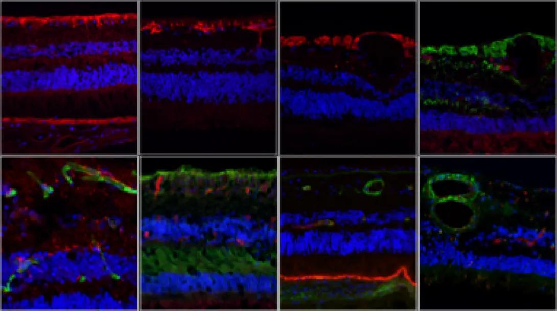 Representative images of immunostaining on retinal cross-sections from human donors targeting various markers used to identify specific retinal cells.