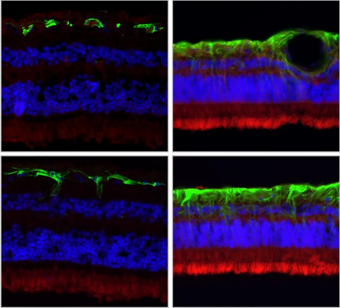 Retinal Cross Sections in four quadrants