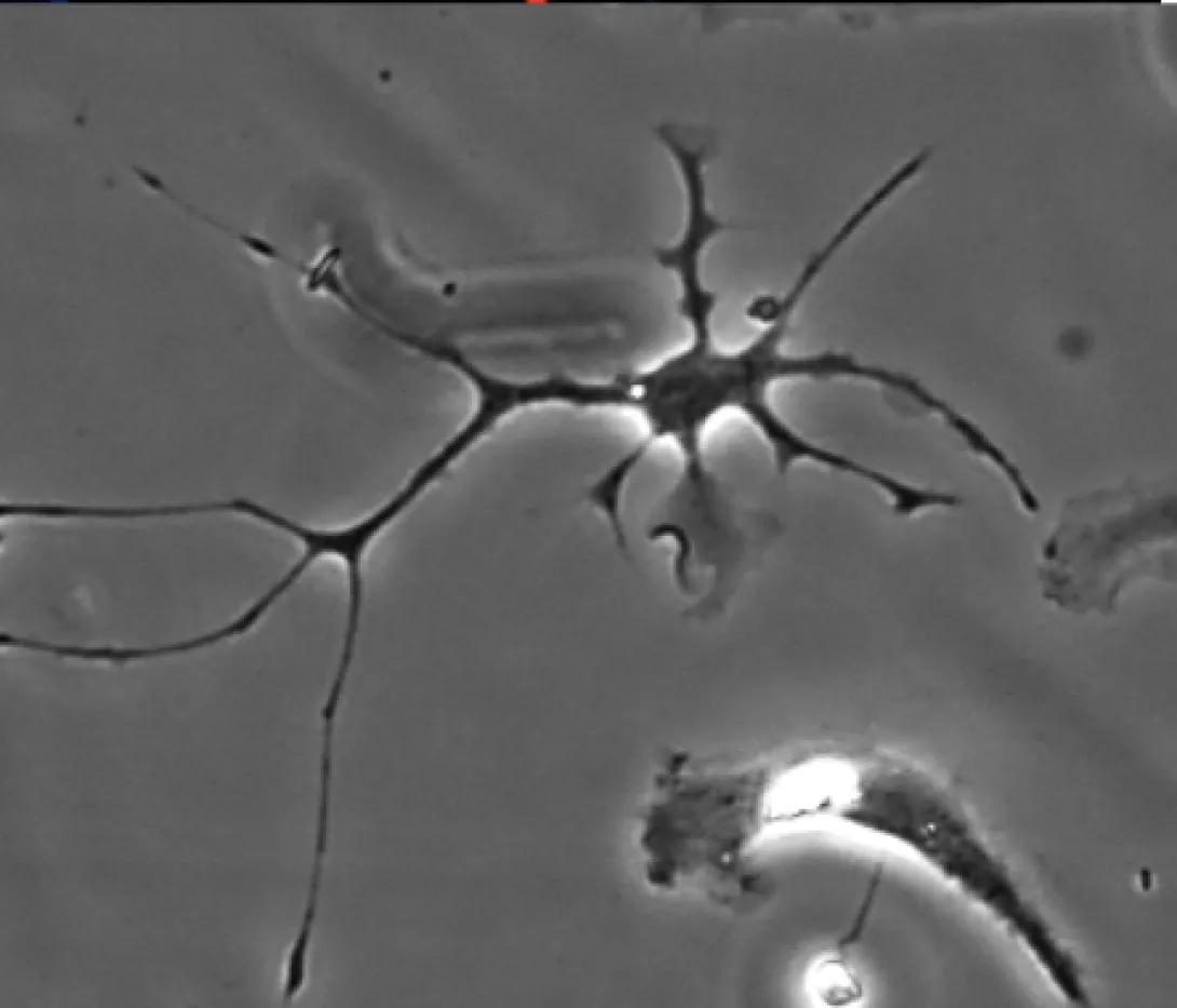 Representative images of a primary microglia in culture