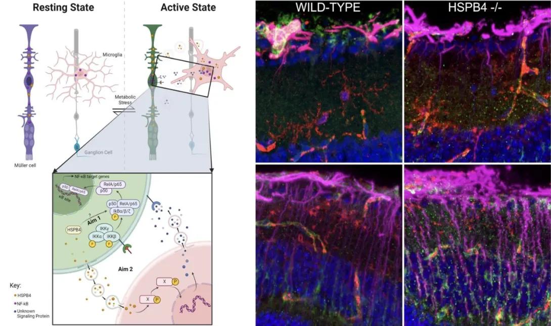 Schematic of the current working model relative to the interplay between Müller glial and microglial cells and its modulation by HSPB4 under normal and disease conditions (left). Representative images of retinal cross-sections from mice expressing (WT) or not HSPB4 (HSPB4-/-) with (right) or without diabetes (left) and stained for a marker of gliosis (purple), a marker of microglia (red) and a marker of inflammation (green).