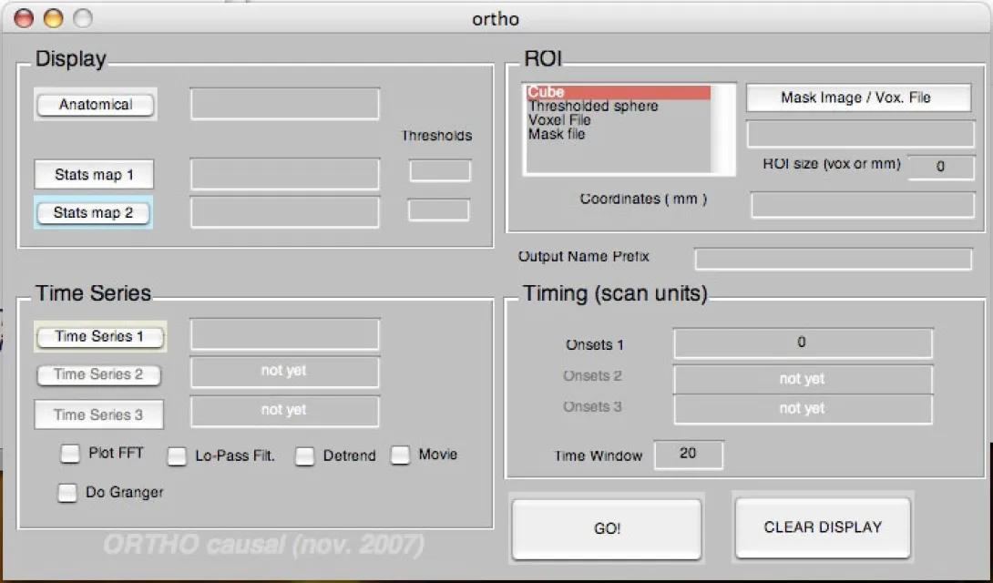 Screenshot of Ortho application interface for neuroimaging analysis