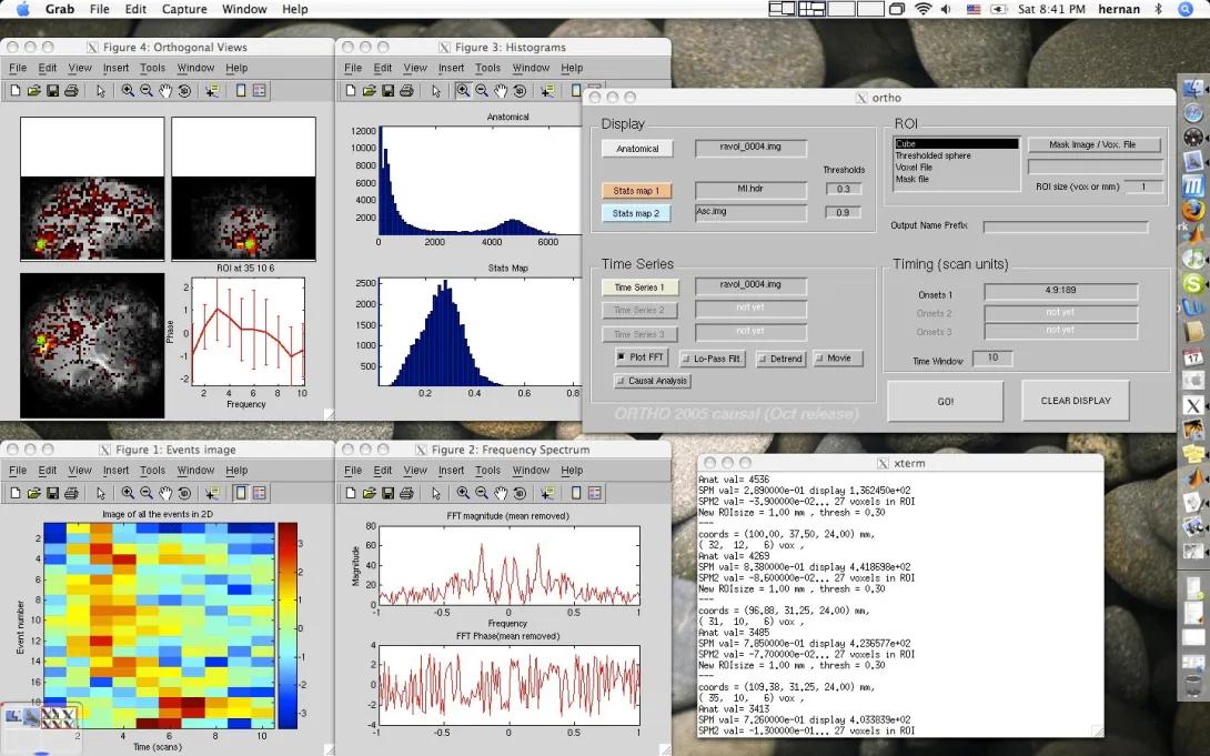 Screenshot of neuroimaging app with multiple overlapping imagesF