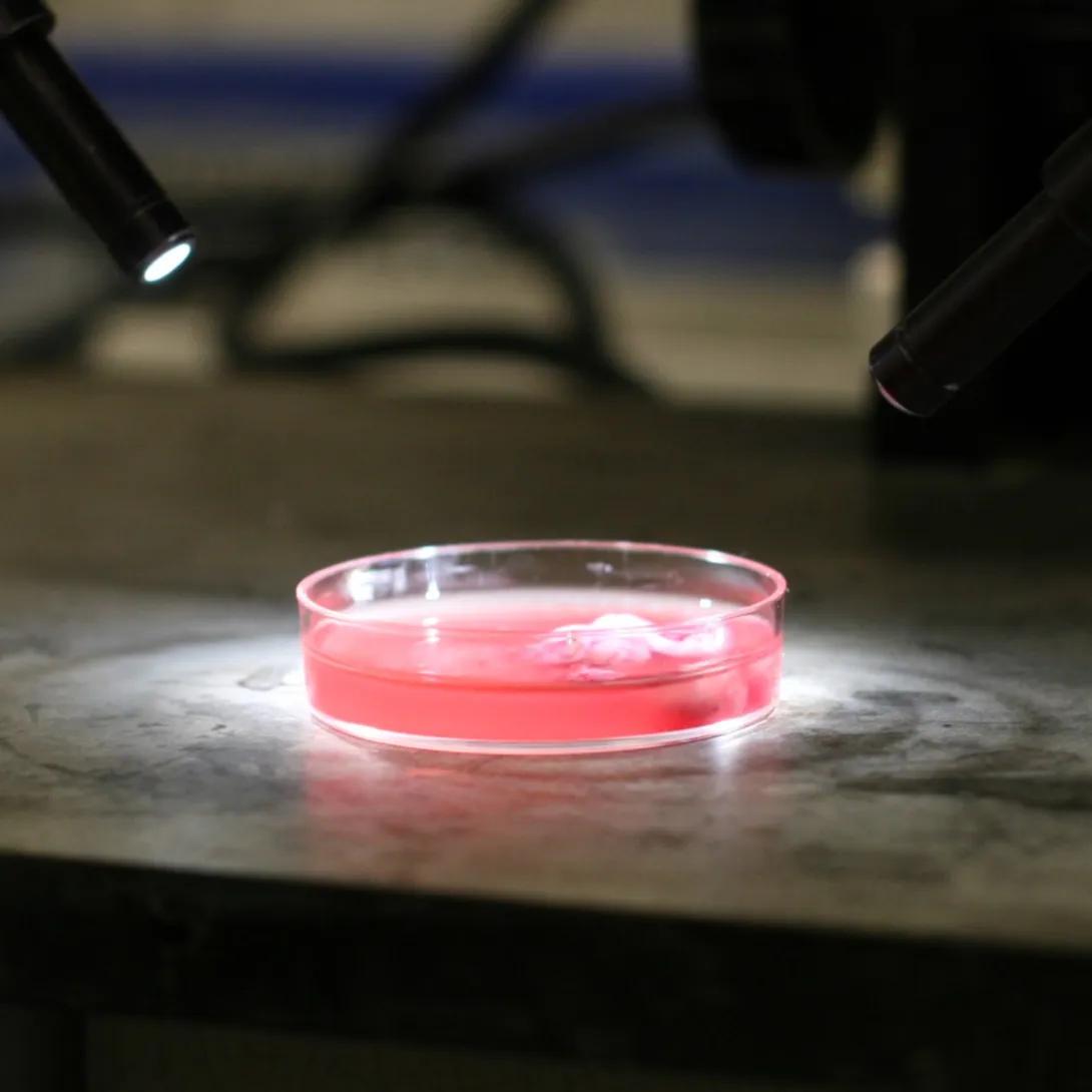 tumor in petri dish