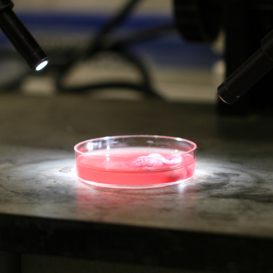 tumor in petri dish