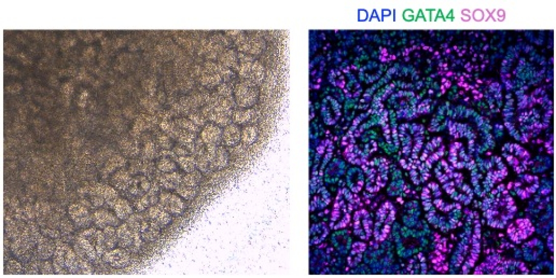 Side-by-side microscopy images of tissue or organoid structures. The left panel shows a brightfield image with densely packed, folded cellular structures in a tan and brown tone. The right panel shows a fluorescent image of the same region labeled DAPI, GATA4 and SOX9, with nuclei stained blue, GATA4-positive cells in green and SOX9-positive cells in magenta, revealing patterned cellular organization within the tissue.