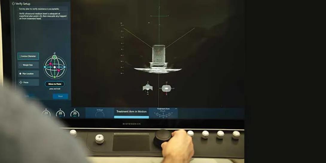 Showing the display panel on a histotripsy machine
