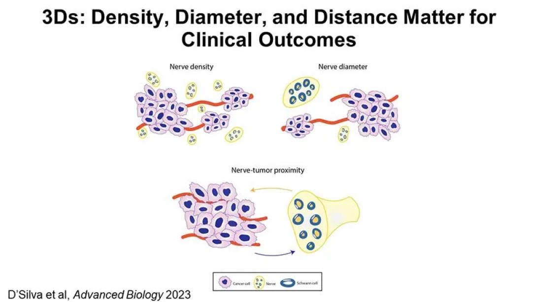 Diagram illustrating how nerve density and nerve diameter impact proximity of nerves to the cancer tumor