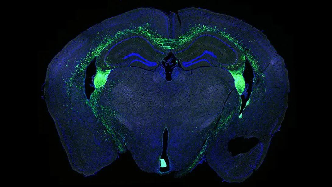 brain stem blue green slice